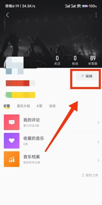 酷我id,酷我音乐qq授权登录不了怎么办图5